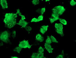 MSI1 Antibody in Immunocytochemistry (ICC/IF)