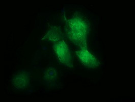 MSI1 Antibody in Immunocytochemistry (ICC/IF)