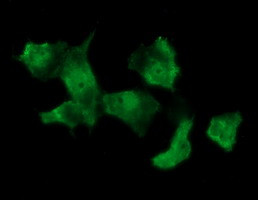 MSI1 Antibody in Immunocytochemistry (ICC/IF)