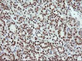 MSI1 Antibody in Immunohistochemistry (Paraffin) (IHC (P))