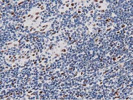 MSI1 Antibody in Immunohistochemistry (Paraffin) (IHC (P))