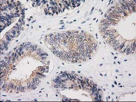 MSI1 Antibody in Immunohistochemistry (Paraffin) (IHC (P))