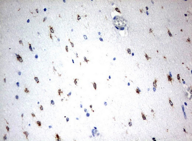 MSI1 Antibody in Immunohistochemistry (Paraffin) (IHC (P))