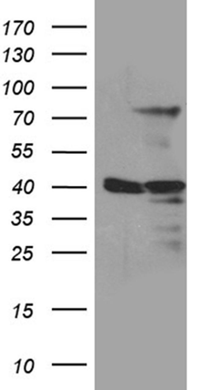 MSL2 Antibody in Western Blot (WB)