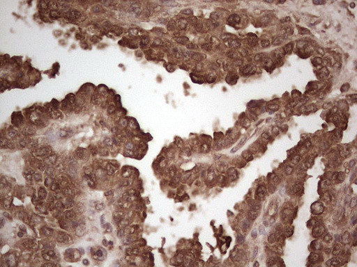 MSLN Antibody in Immunohistochemistry (Paraffin) (IHC (P))