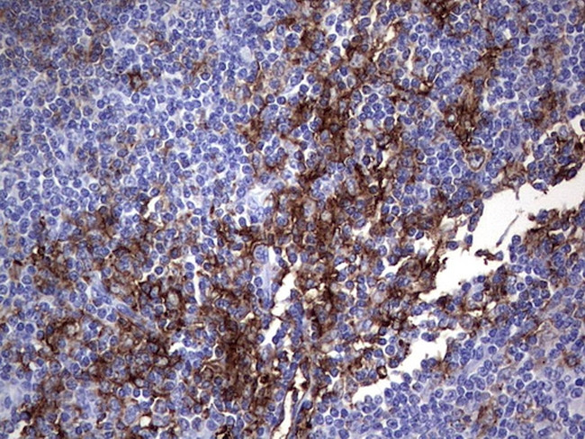 MSLN Antibody in Immunohistochemistry (Paraffin) (IHC (P))