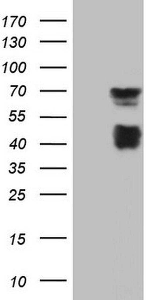 MSLN Antibody in Western Blot (WB)