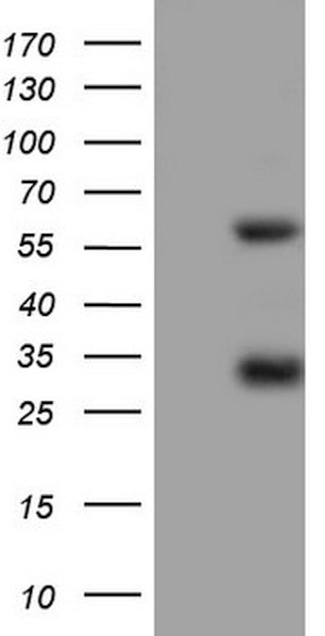 MSLN Antibody in Western Blot (WB)