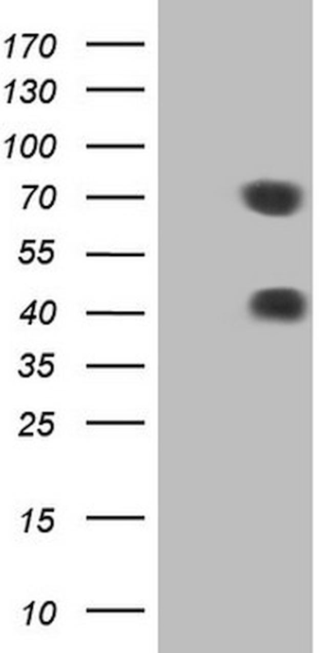 MSLN Antibody in Western Blot (WB)