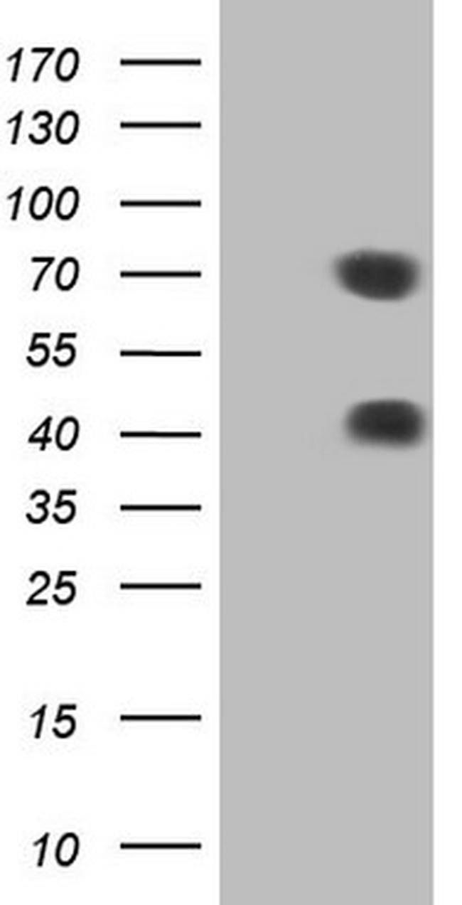 MSLN Antibody in Western Blot (WB)