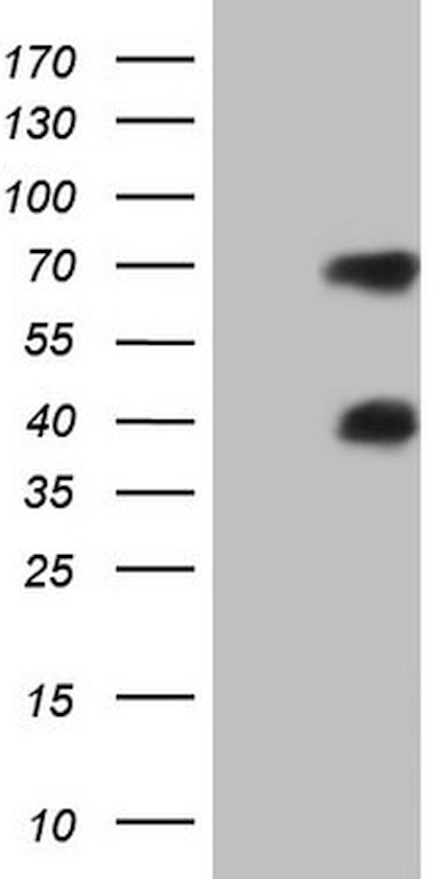 MSLN Antibody in Western Blot (WB)