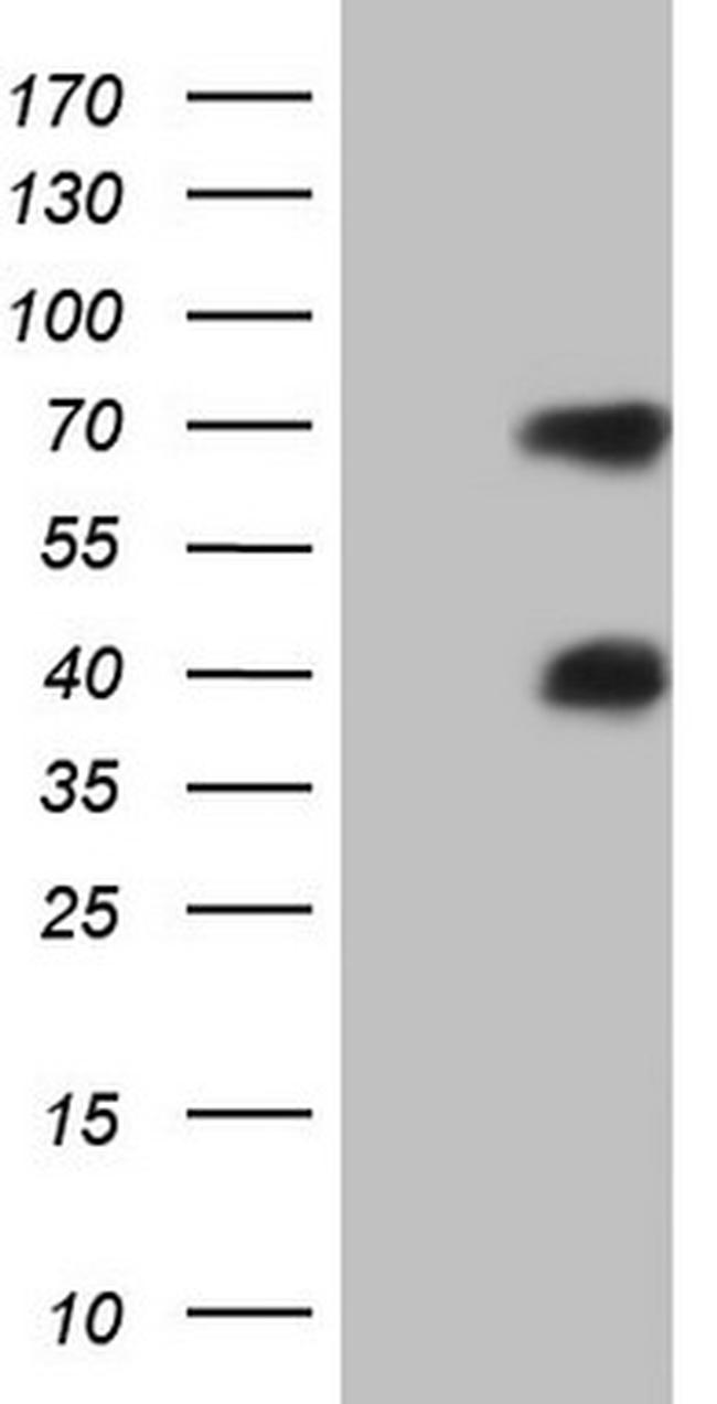 MSLN Antibody in Western Blot (WB)