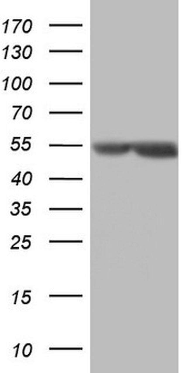 MSLN Antibody in Western Blot (WB)