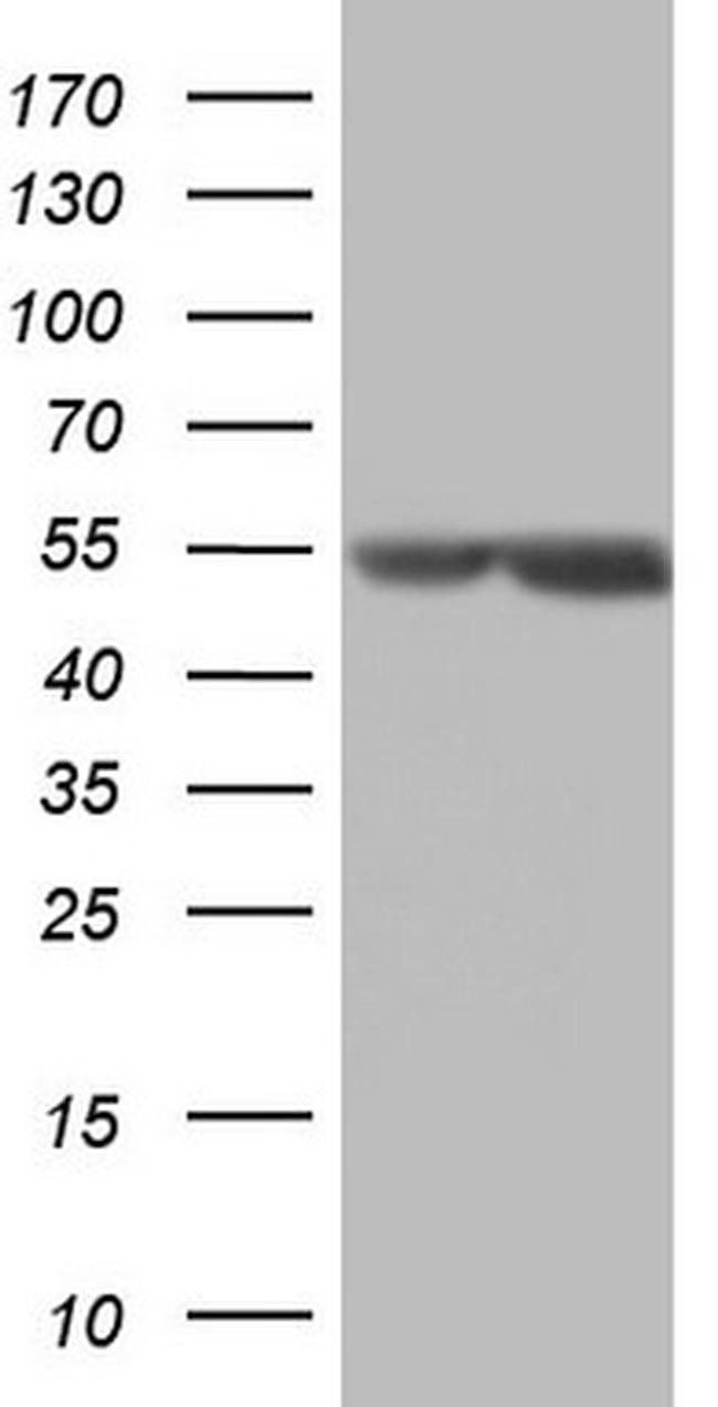 MSLN Antibody in Western Blot (WB)