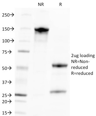 Cytomegalovirus p65 (CMV-p65) Antibody in SDS-PAGE (SDS-PAGE)
