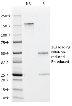 EBV Early Antigens (Epstein Barr Virus) Antibody in SDS-PAGE (SDS-PAGE)