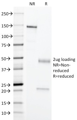 Erythrocyte Specific Antibody in SDS-PAGE (SDS-PAGE)