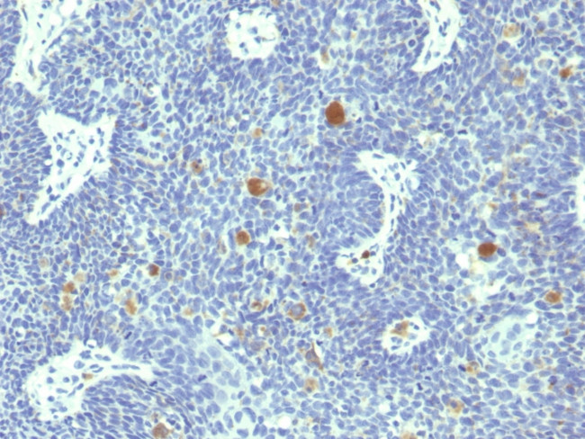 HPV-18 (Human Papilloma Virus 18) Antibody in Immunohistochemistry (Paraffin) (IHC (P))