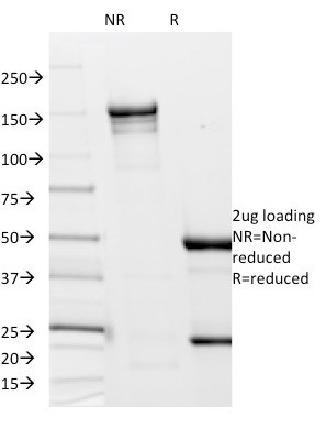 Borrelia burgdorferi (p41 Flagellin) Antibody in SDS-PAGE (SDS-PAGE)