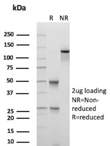 DNA-RNA Hybrid Antibody in SDS-PAGE (SDS-PAGE)
