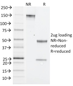 NK1.1/CD161c/Klrb1c Antibody in SDS-PAGE (SDS-PAGE)