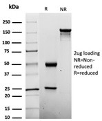 Penicillin (Group of beta-Lactam Antibiotics) Antibody in SDS-PAGE (SDS-PAGE)