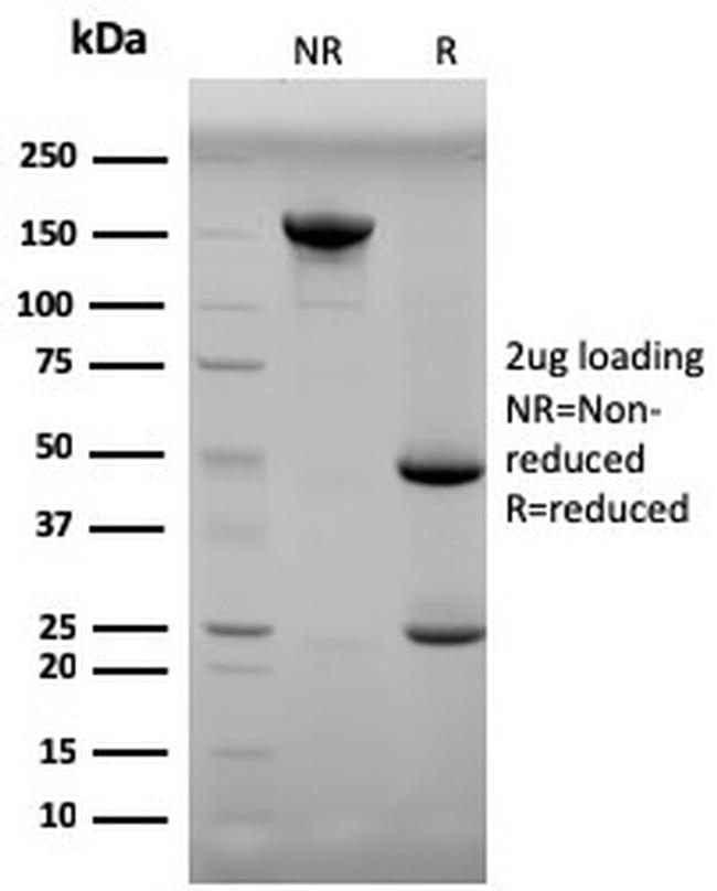 Progesterone Antibody in SDS-PAGE (SDS-PAGE)
