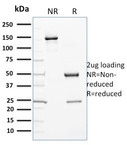 Cytochrome P450 3A1/CYP3A1 Antibody in SDS-PAGE (SDS-PAGE)