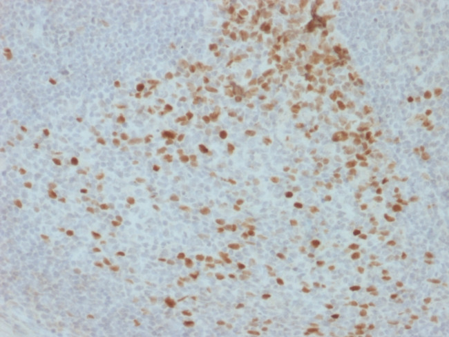 Proliferation Marker Antibody in Immunohistochemistry (Paraffin) (IHC (P))