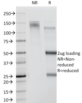 CDw78 Antibody in SDS-PAGE (SDS-PAGE)