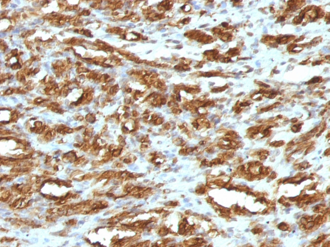 Actin, Muscle Specific (Muscle Cell Marker) Antibody in Immunohistochemistry (Paraffin) (IHC (P))