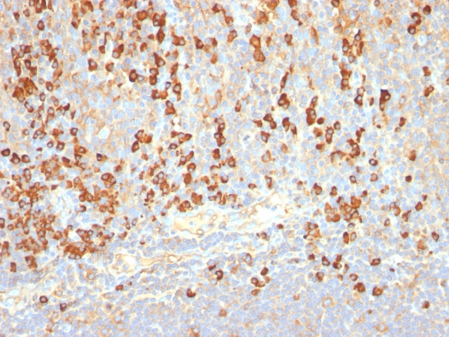 Plasma Cell Marker Antibody in Immunohistochemistry (Paraffin) (IHC (P))