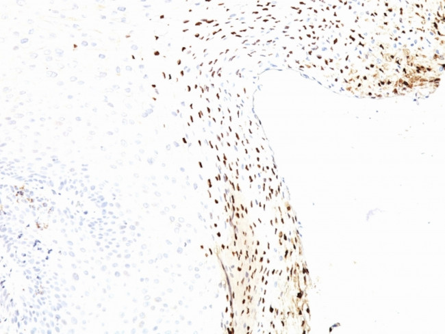 HPV-16 (Human Papilloma Virus 16) Antibody in Immunohistochemistry (Paraffin) (IHC (P))