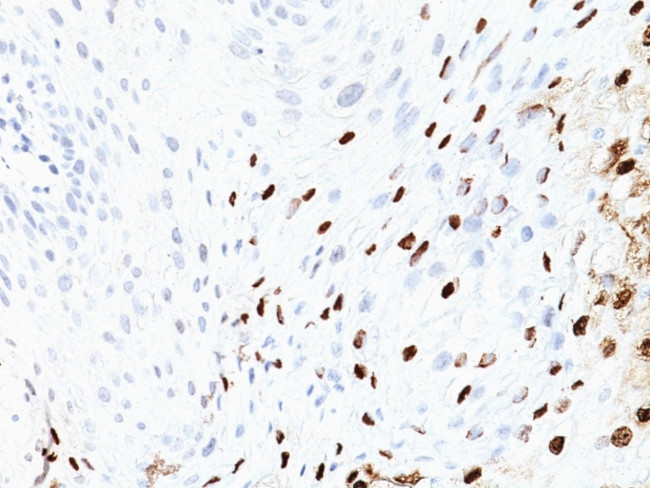 HPV-16 (Human Papilloma Virus 16) Antibody in Immunohistochemistry (Paraffin) (IHC (P))