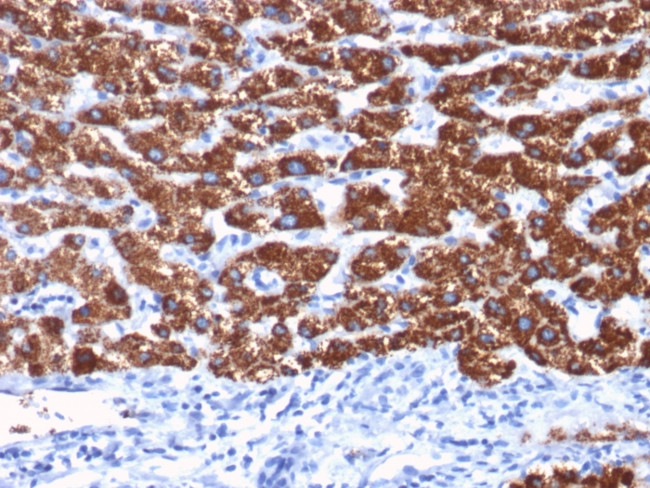 Hepatocyte Specific Antigen (Hepatocellular Marker) Antibody in Immunohistochemistry (Paraffin) (IHC (P))