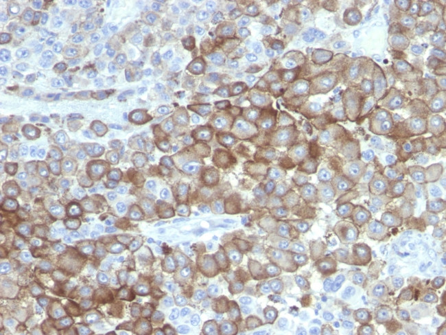 PNL2 (Melanoma Associated Antigen) Antibody in Immunohistochemistry (Paraffin) (IHC (P))