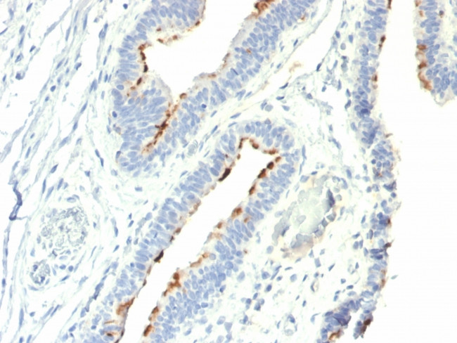 Thomsen-Friedenreich Antigen/CD176 (Pan Carcinoma Marker) Antibody in Immunohistochemistry (Paraffin) (IHC (P))