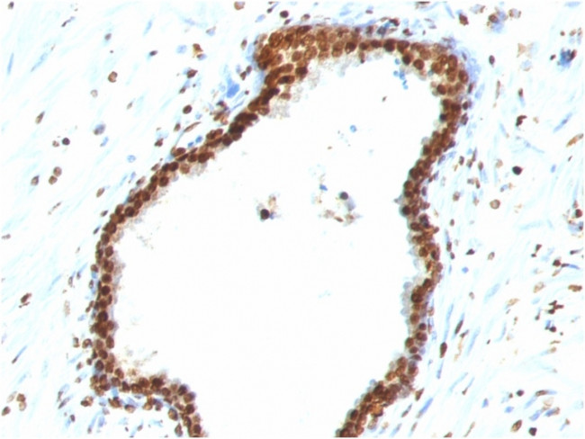 Double Stranded DNA (dsDNA) (Nuclear Marker) Antibody in Immunohistochemistry (Paraffin) (IHC (P))