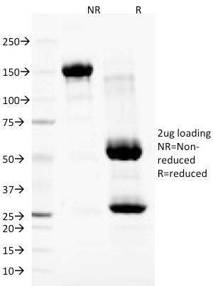 Nuclear Membrane Marker Antibody in SDS-PAGE (SDS-PAGE)