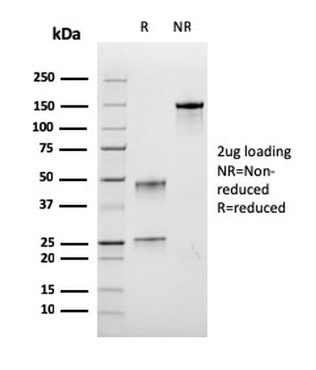 Bromodeoxyuridine (BrdU) Antibody in SDS-PAGE (SDS-PAGE)