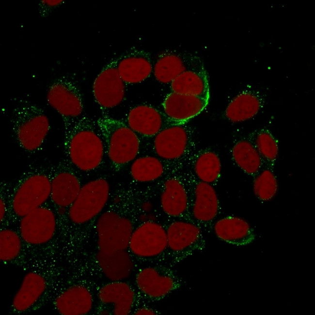 Cytokeratin 10/13 Antibody in Immunocytochemistry (ICC/IF)