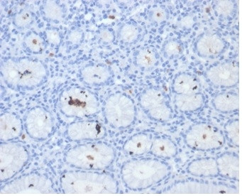 Helicobacter pylori (Catalase) Antibody in Immunohistochemistry (Paraffin) (IHC (P))