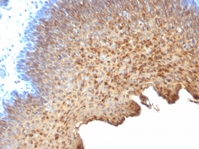 Cytokeratin 10/13 Antibody in Immunohistochemistry (Paraffin) (IHC (P))
