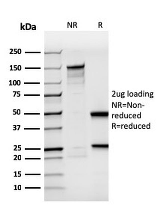 Bromodeoxyuridine (BrdU) Antibody in SDS-PAGE (SDS-PAGE)