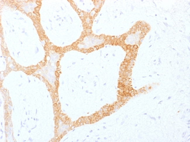 Cytokeratin 5/8 Antibody in Immunohistochemistry (Paraffin) (IHC (P))