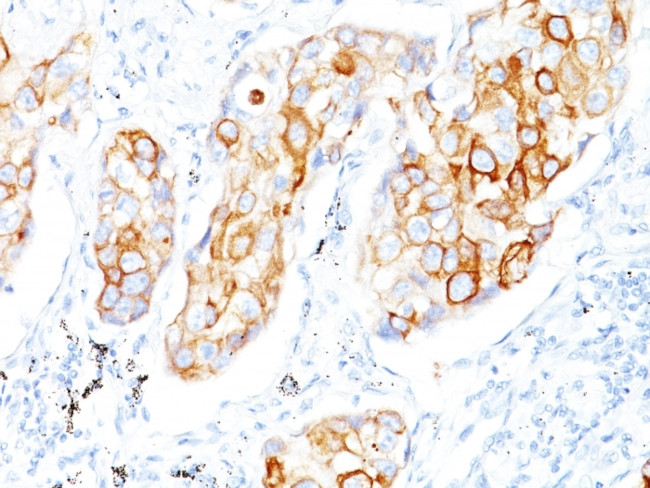 Cytokeratin 7/17 Antibody in Immunohistochemistry (Paraffin) (IHC (P))