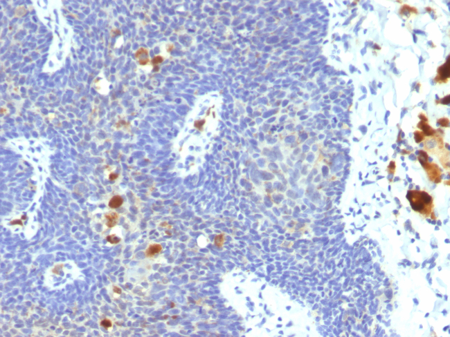HPV-16 (Human Papilloma Virus 16) Antibody in Immunohistochemistry (Paraffin) (IHC (P))