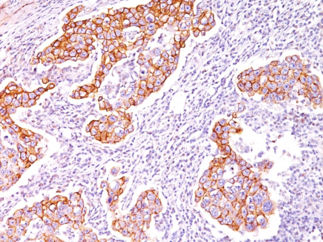 Phosphotyrosine (P-Tyr) Antibody in Immunohistochemistry (Paraffin) (IHC (P))