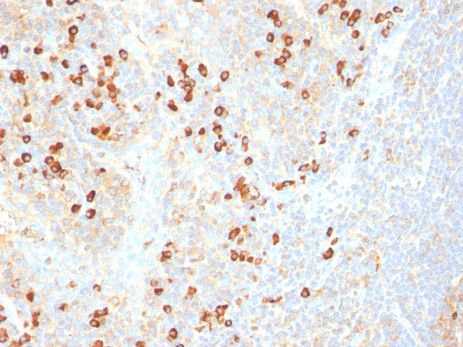 Plasma Cell Marker Antibody in Immunohistochemistry (Paraffin) (IHC (P))