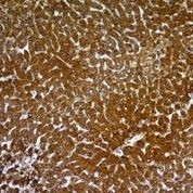 Hepatocyte Specific Antigen (Hepatocellular Marker) Antibody in Immunohistochemistry (Paraffin) (IHC (P))